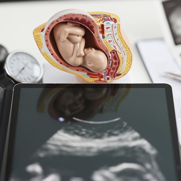 monitorizacion fetal